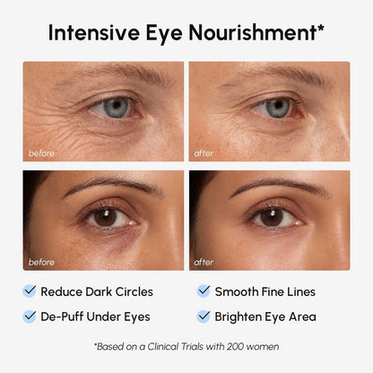 MAREE Invisible Under Eye Patches for Puffy Eyes and Dark Circles with Peptide Collagen, Caffeine & Retinol - Eye Masks for Women & Men for Undereye Bags & Puffiness Reducing - Parches para Ojeras MAREE