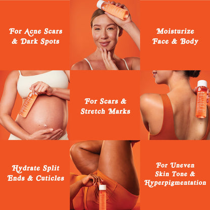 Bio-Oil Skincare Body Oil Serum for Scars and Stretch Marks, Face and Body Moisturizer with Vitamin E & A for Sensitive Dry Skin, Dermatologist Recommended, Non-Comedogenic, 4.2 Oz Bio-Oil