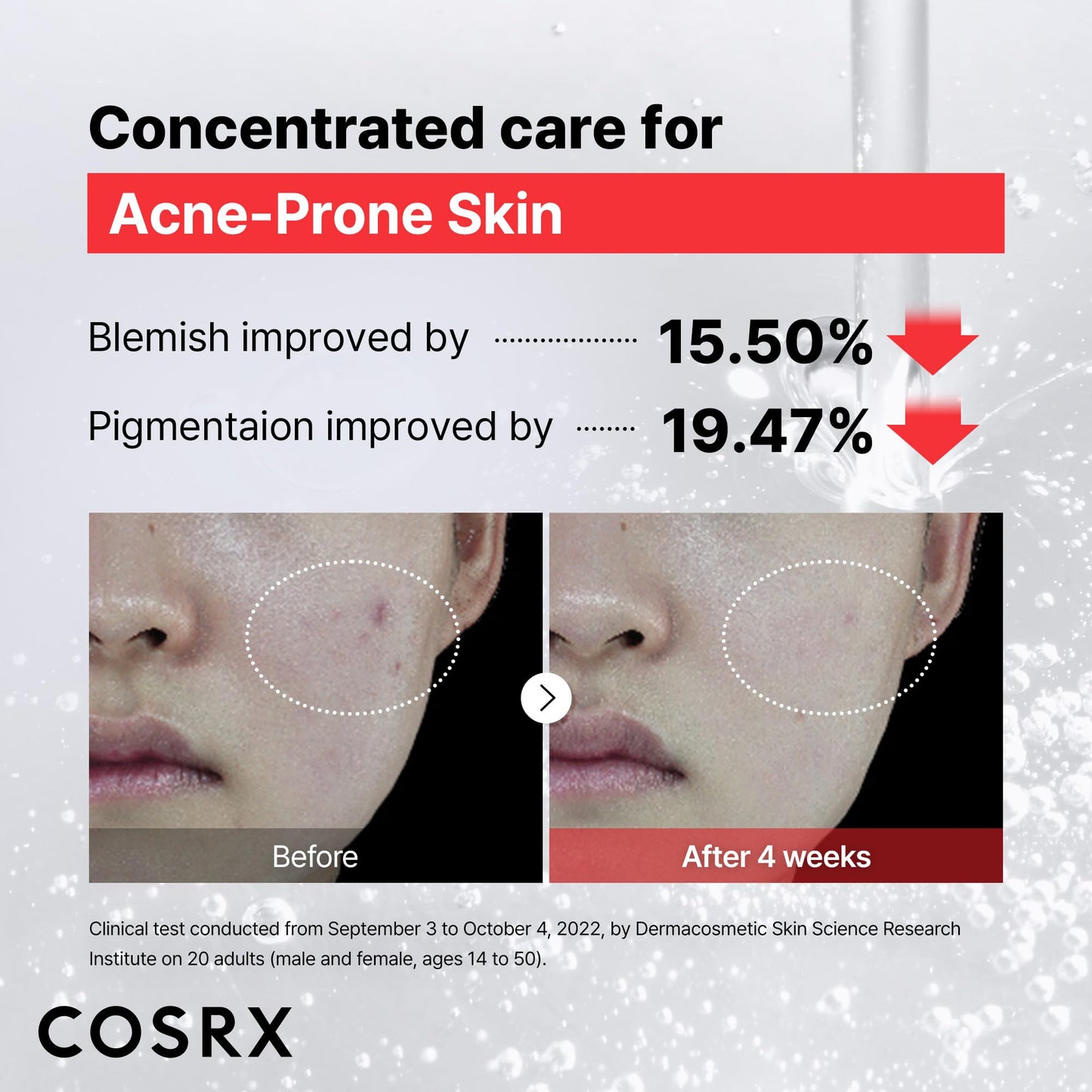 COSRX 15% Niacinamide Face Serum, 0.67 fl oz, Pore Minimizer Serum for Face, Even Skin Tone, Korean Skin Care COSRX