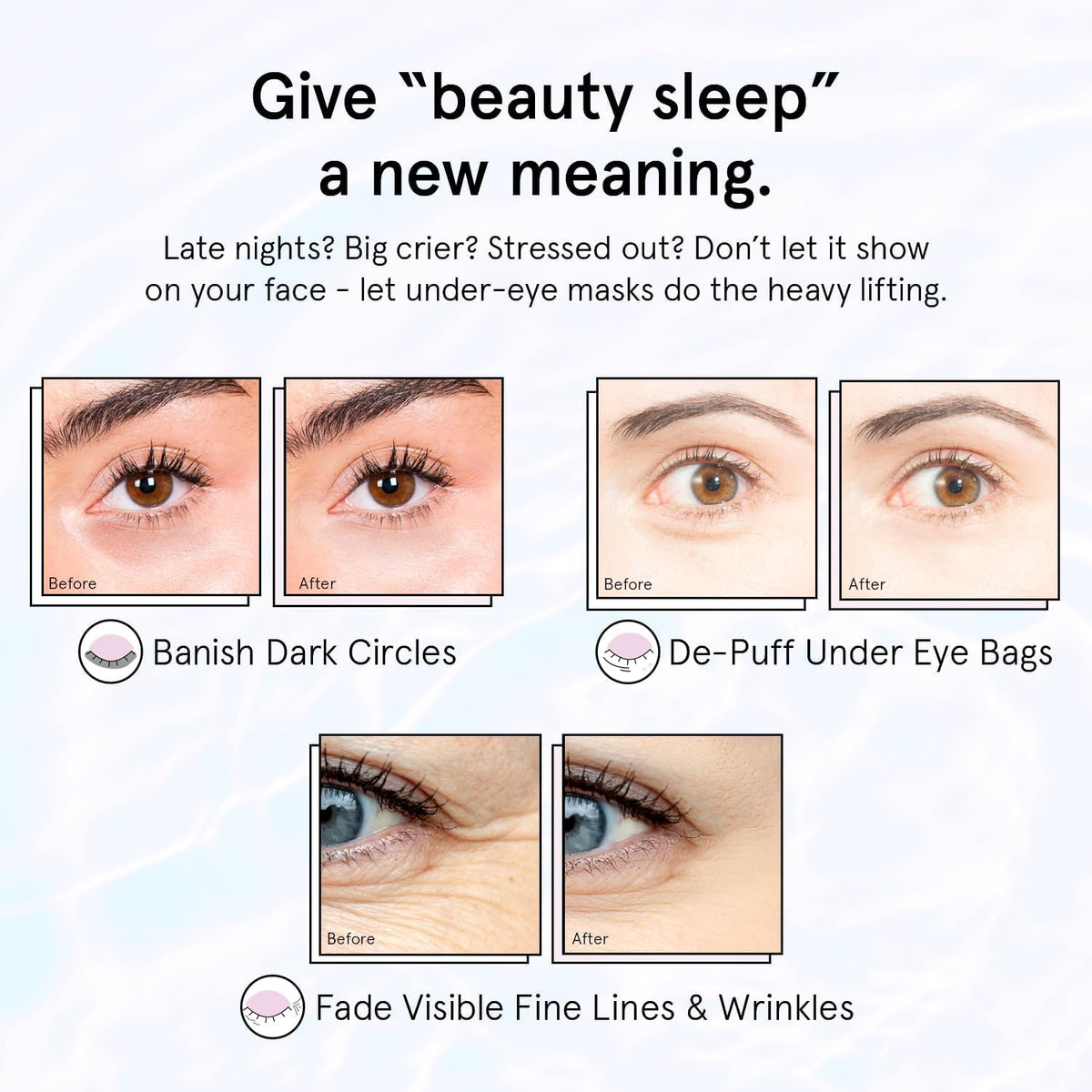 grace & stella Retinol Under Eye Patches for Puffy Eyes grace & stella
