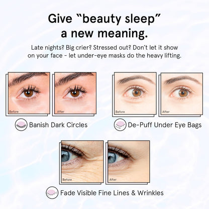 grace & stella Retinol Under Eye Patches for Puffy Eyes grace & stella
