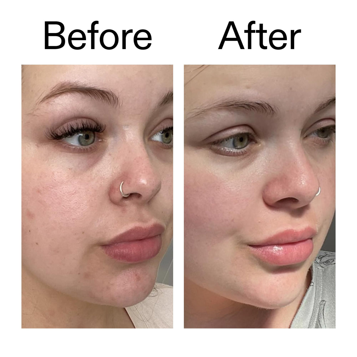 The INKEY List Omega Water Cream, Oil-Free Face Moisturiser, Lightweight Gel, Vegan Friendly Skincare, Suitable For Blemish Prone Skin The INKEY List