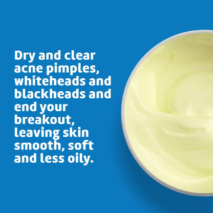 De La Cruz 10% Sulfur Ointment, Cystic Acne Treatment Face, Body 2.6oz jar De La Cruz