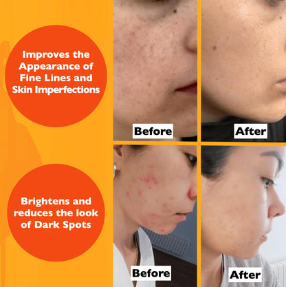 Vitamin C Serum For Face – Anti Aging Face Serum with Vitamin C, Hyaluronic Acid, Vitamin E. Brightening Formula. Improve Appearance of Dark Spots, Tone, Fine Lines & Wrinkles, Glowing Skin 2 Fl Oz Florence
