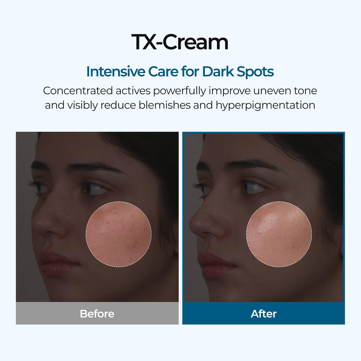 DR.Melaxin TX Tranexamic Acid CREAM | Skin freckle Cream, Blemishes, Anti-pigmetation korean skin care | Korean Cosmetics | 1.7 fl oz (50 ml) Dr.Melaxin