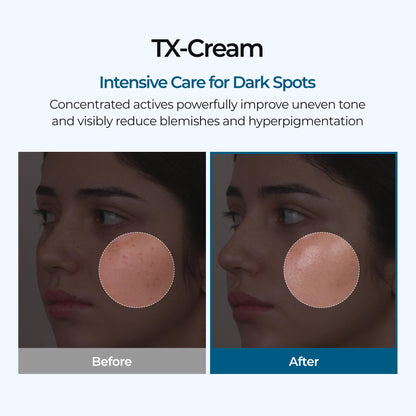 DR.Melaxin TX Tranexamic Acid CREAM | Skin freckle Cream, Blemishes, Anti-pigmetation korean skin care | Korean Cosmetics | 1.7 fl oz (50 ml) Dr.Melaxin