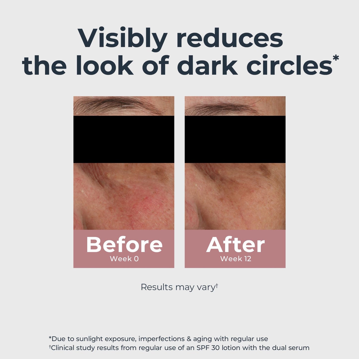 Eucerin Radiant Tone Eye Cream Dark Circle Corrector, Eye Brightening Cream with Thiamidol and Hyaluronic Acid Eucerin