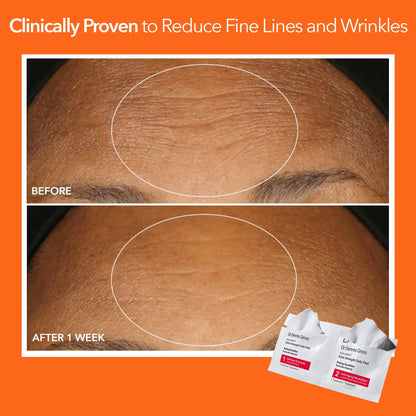 Dr Dennis Gross Alpha Beta Extra Strength Exfoliating Daily Peel - 5 Pack Dr Dennis Gross