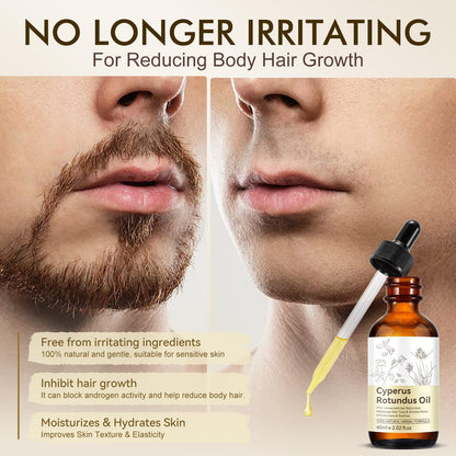 Cyperus Rotundus Oil, Natural for Reducing Body Hair Growth, Cyperus Rotundus Oil for Hair Removal, Reduces Unwanted Hair Growth, Reducing Body Hair Growth, Shrink Pores - 2.02 Fl Oz DLOMFVFQ