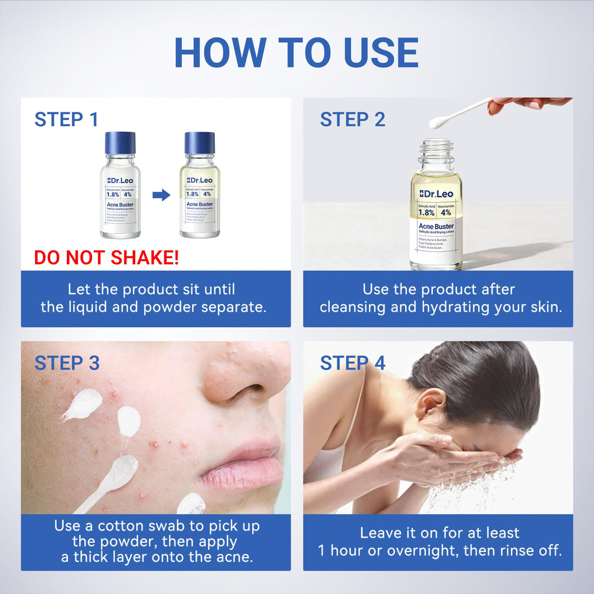 Dr.Leo 1.8% Salicylic Acid Acne Spot Treatment Drying Lotion, 0.34oz Dr.Leo