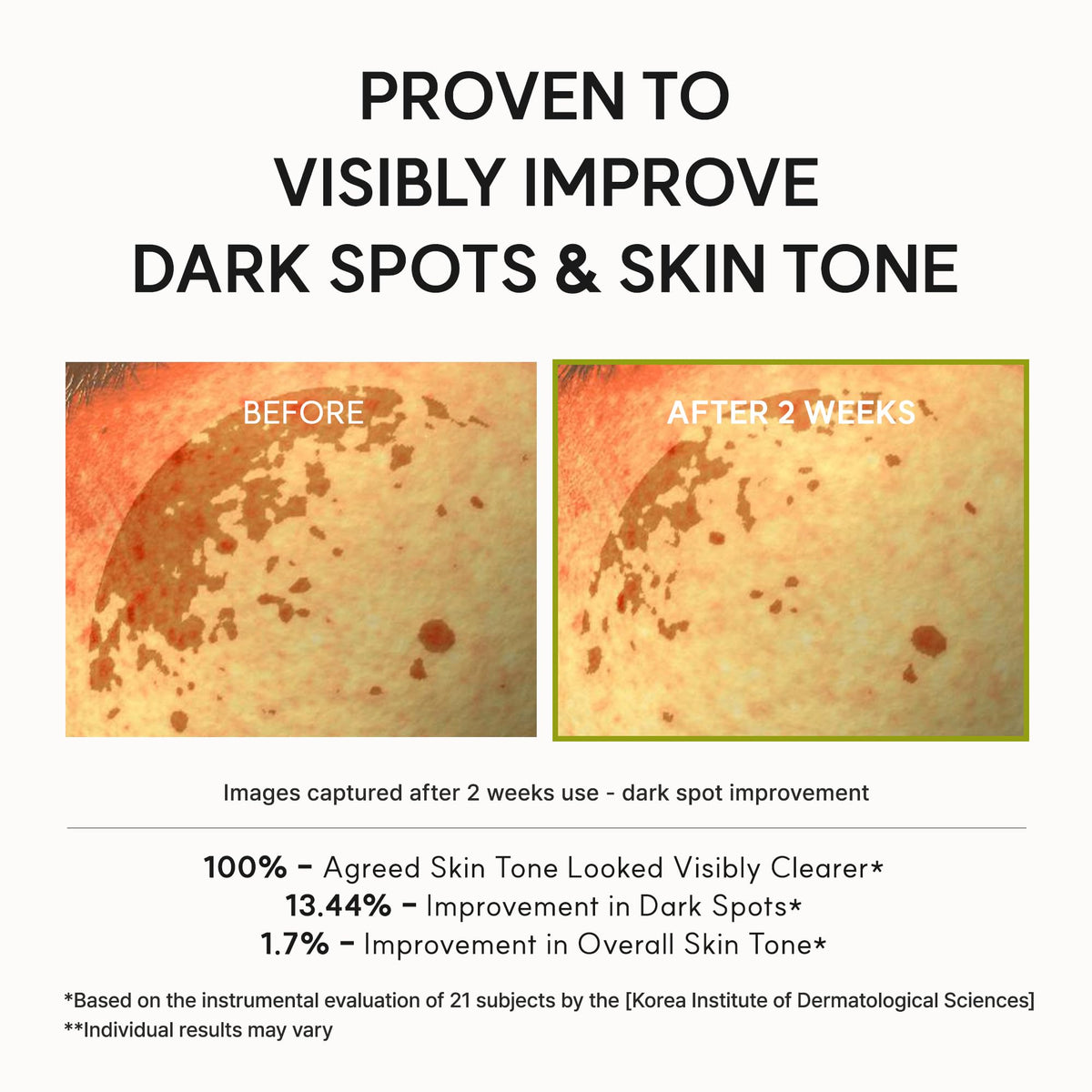 Arencia Vitamin C Booster Shot Serum with Glutathione, Niacinamide and Vitamin E for Dark Spot Care, Fine Lines & Wrinkles, Glass Skin, Korean Skincare 30ml/1.01 fl.oz ARENCIA