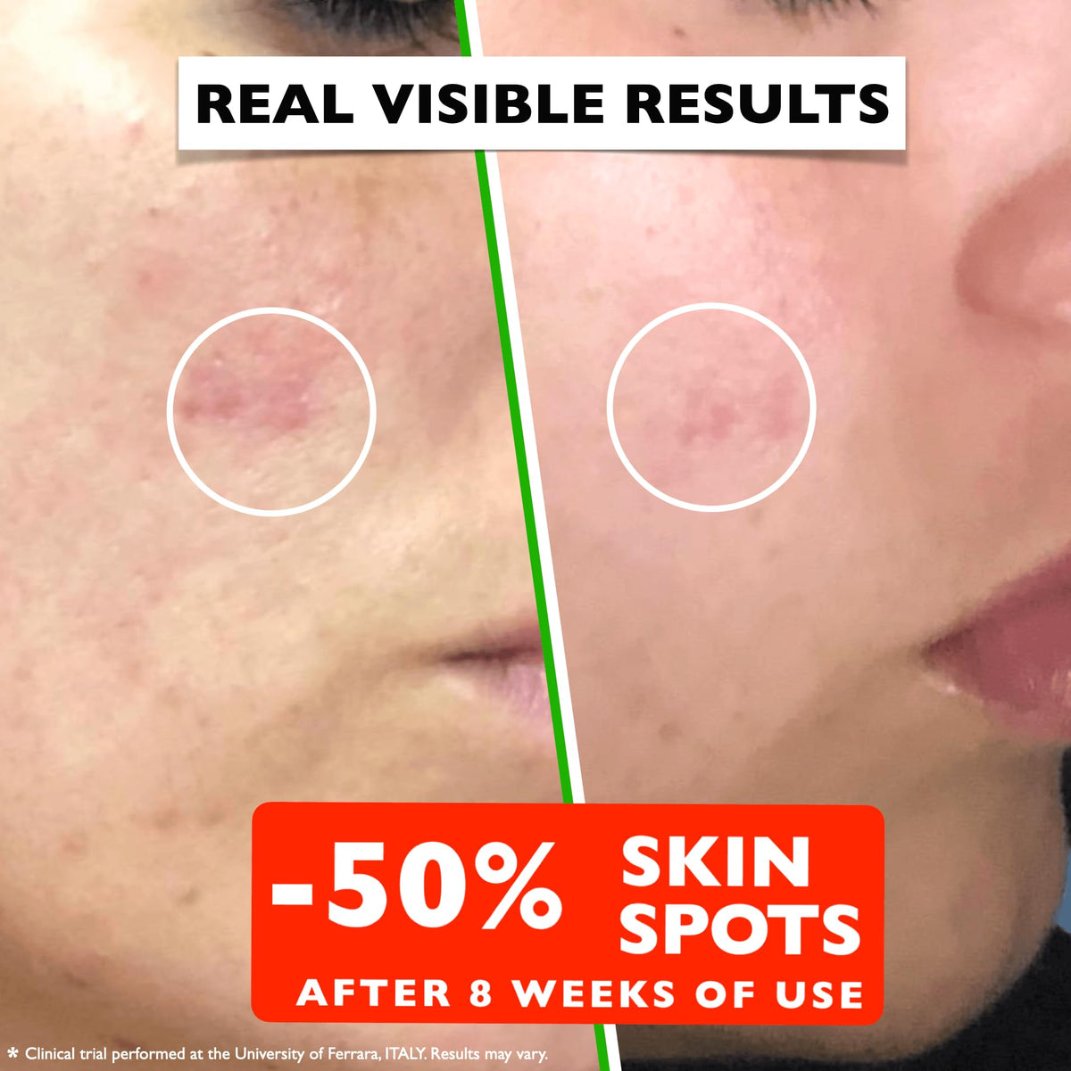 Vitamin C Serum For Face – Anti Aging Face Serum with Vitamin C, Hyaluronic Acid, Vitamin E. Brightening Formula. Improve Appearance of Dark Spots, Tone, Fine Lines & Wrinkles, Glowing Skin 2 Fl Oz Florence