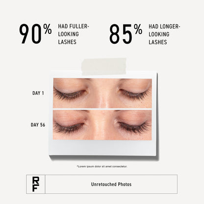 Rodan + Fields R+F Lash Boost Serum | 5 ml | Supports Fuller, Longer-Looking Eyelashes & Brows | Easy Nightly Application RODAN + FIELDS