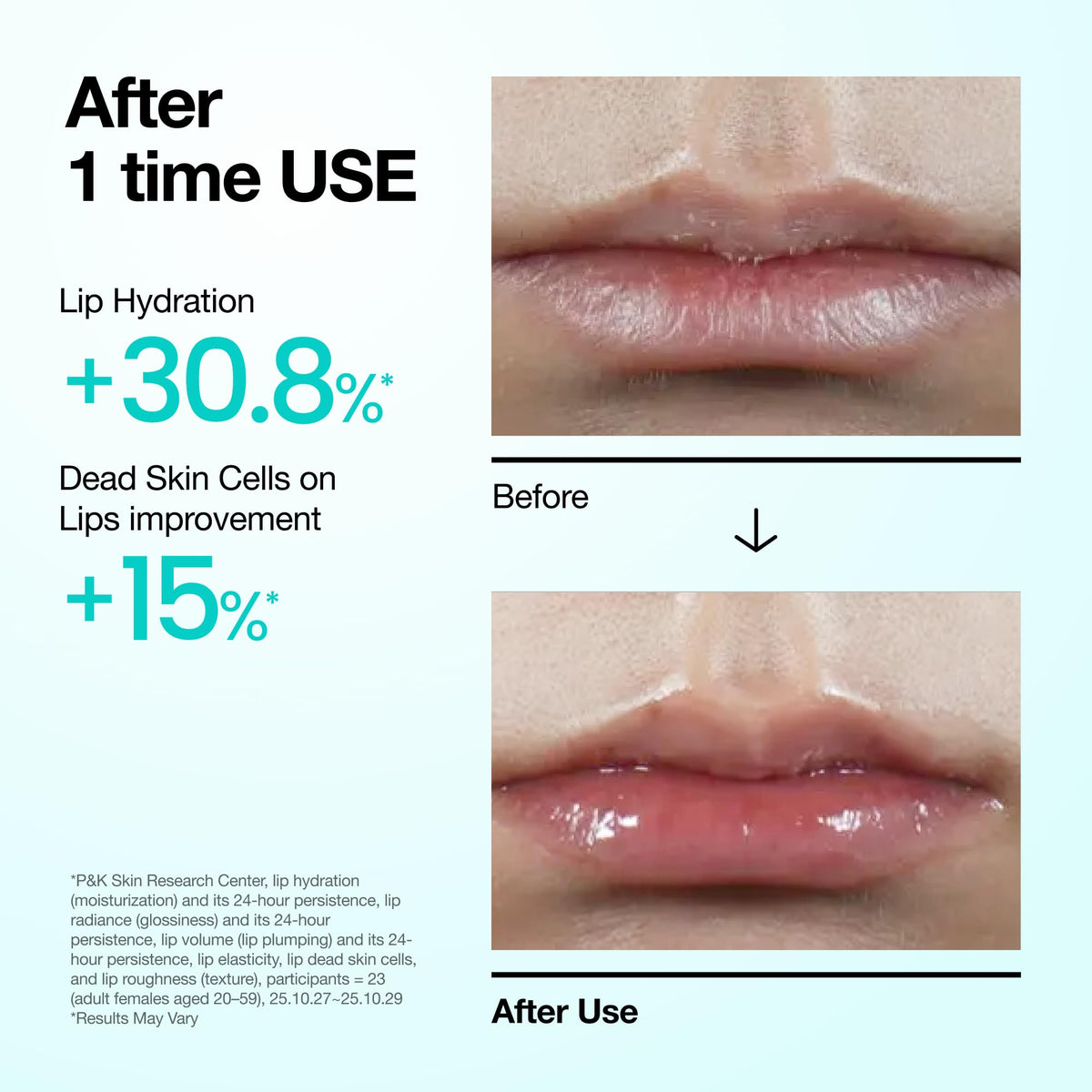 Anua PDRN Lip Serum, 0.33 fl.oz ANUA
