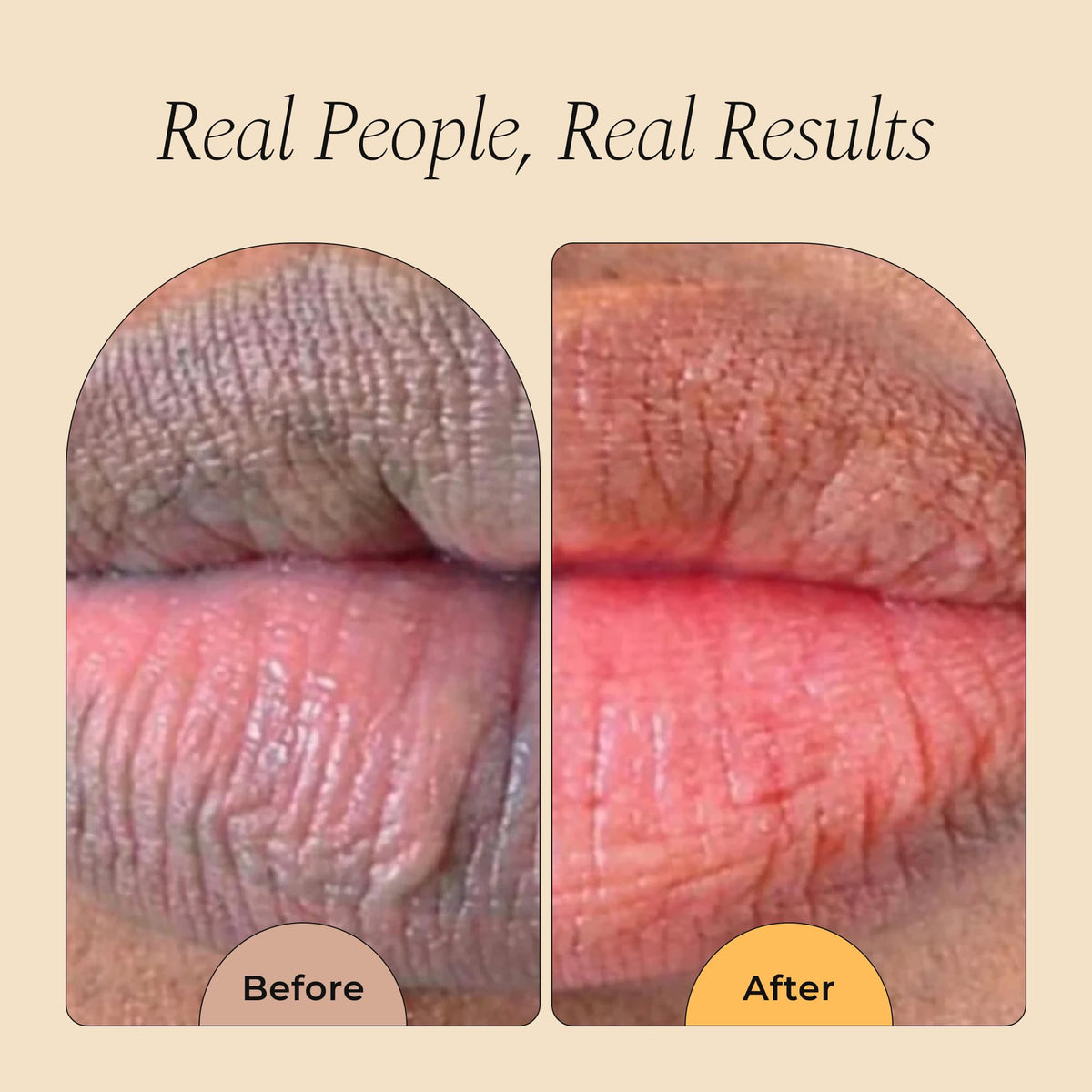 Glo Melanin Natural Lemon & Turmeric Lip Balm - Brighten, Nourish Dark Lips Glo Melanin