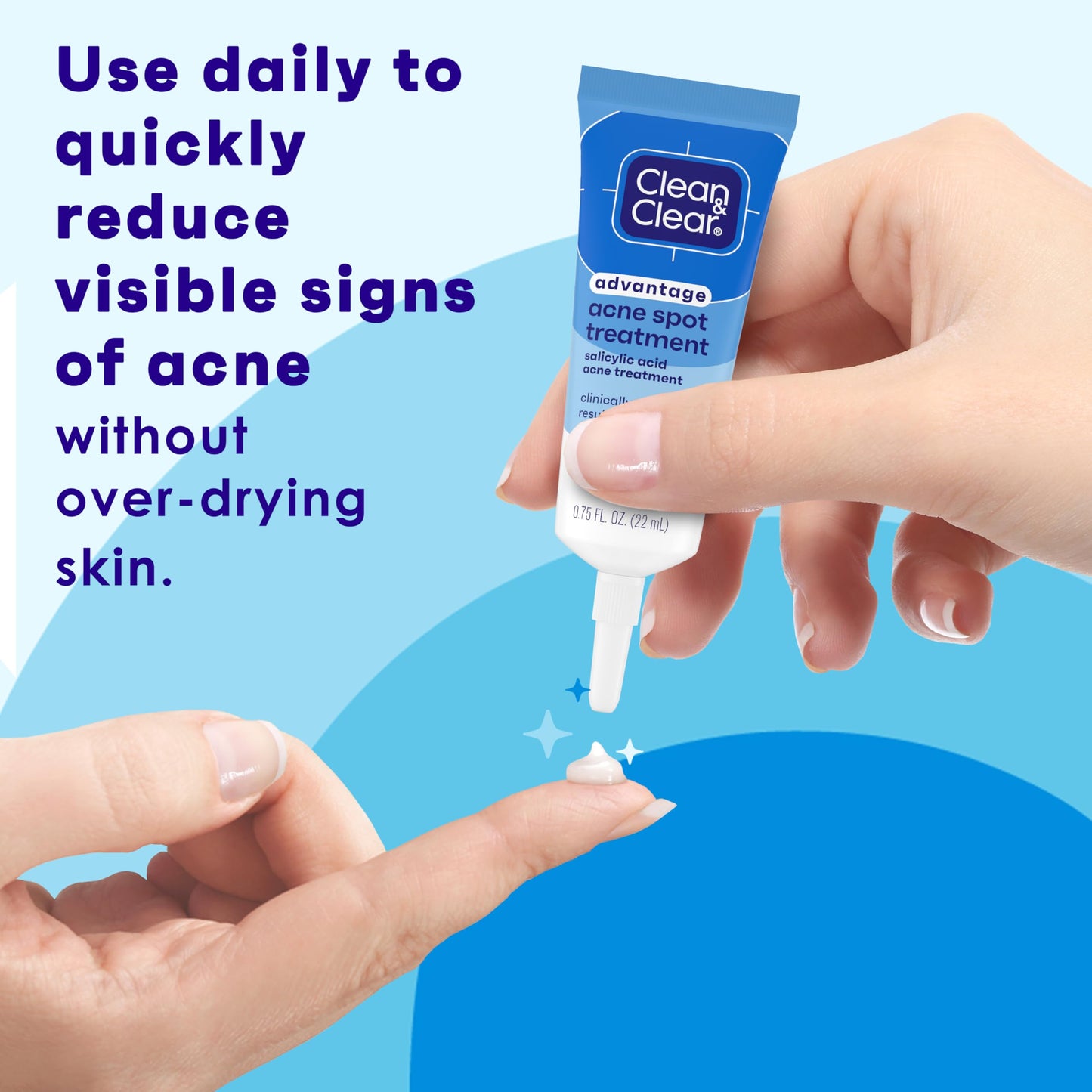 Clean and Clear Advantage Acne Spot Treatment Gel Cream with 2% Salicylic Acid & Witch Hazel, Acne Pimple Medication Clean & Clear