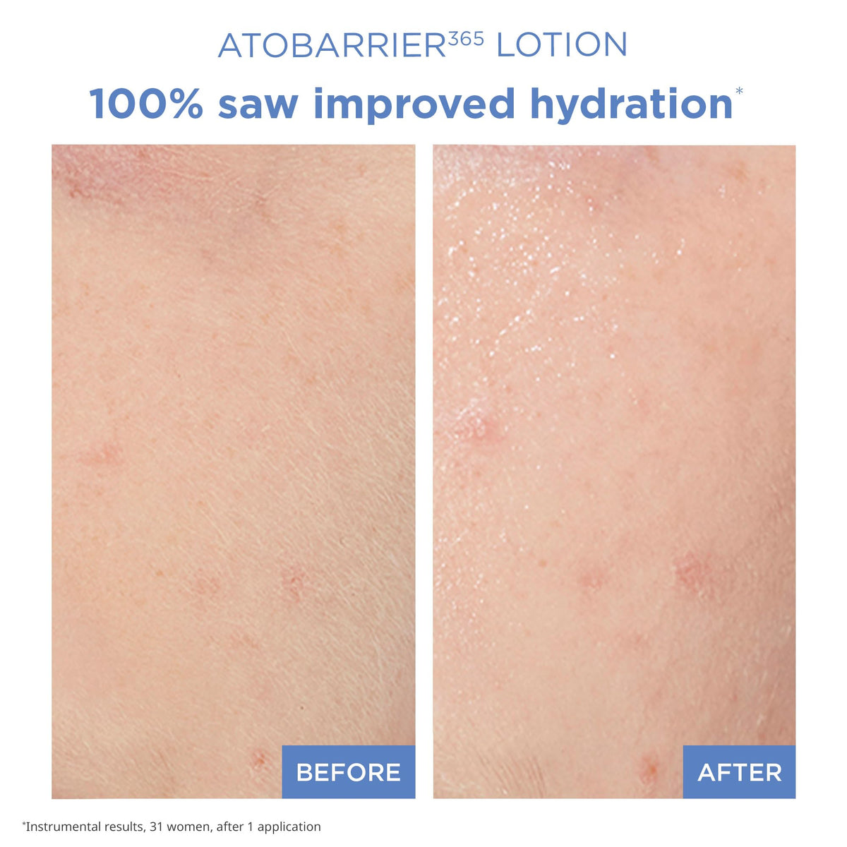 AESTURA ATOBARRIER365 Lightweight Korean Face Moisturizer with Ceramides | Strengthens Barrier, Fast-Absorbing Hydration, Suitable for Dry, Normal & Sensitive Skin, 150ML / 5.07 fl. Oz. AESTURA