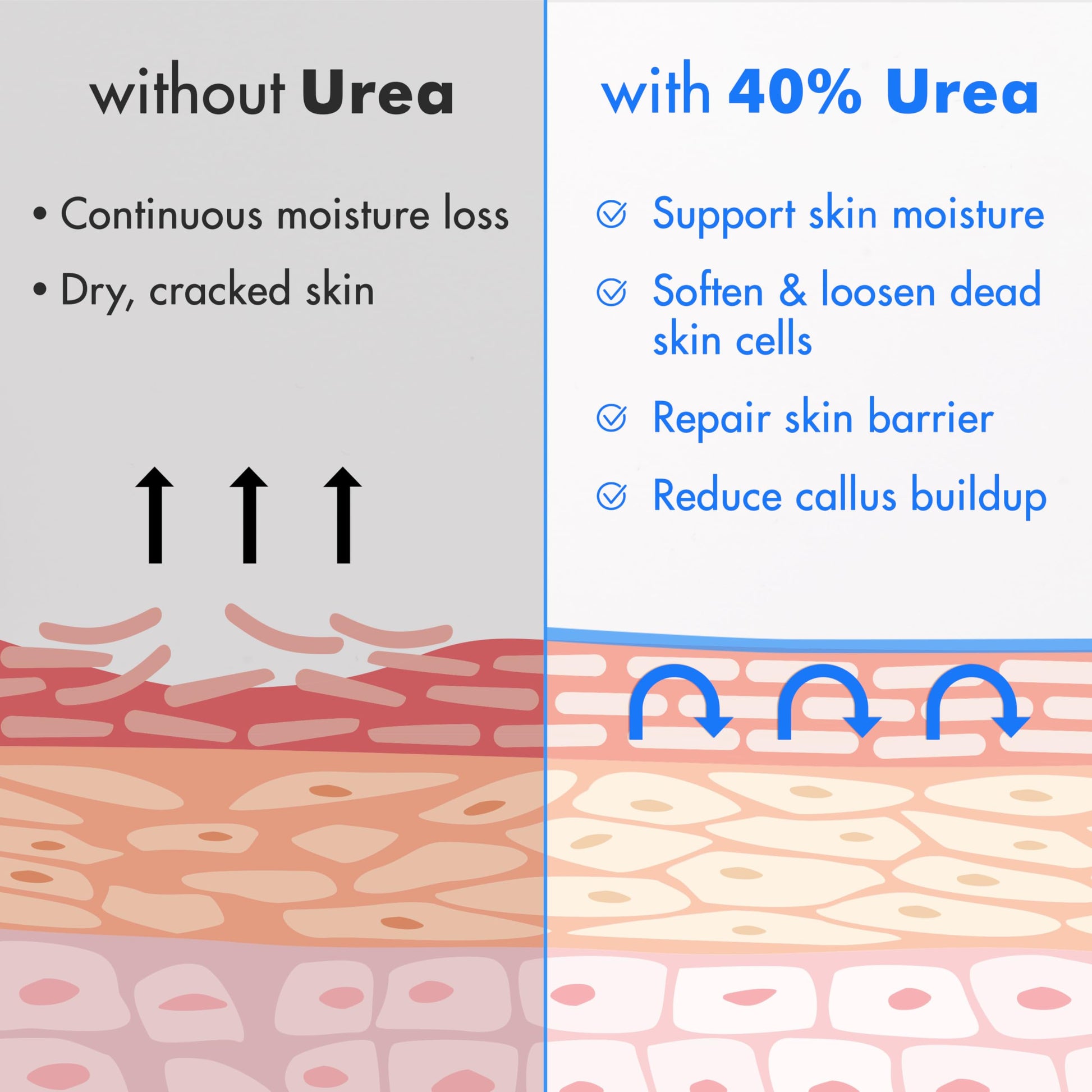 Ebanel Urea Cream 40% plus Salicylic Acid 2%, Foot Cream for Dry Cracked Heels Feet Knees Elbows Hands, Foot Dead Skin Cuticle Callus Remover Toenail Softener, Keratolytic Skin Barrier Repair Ebanel buy australia supplements