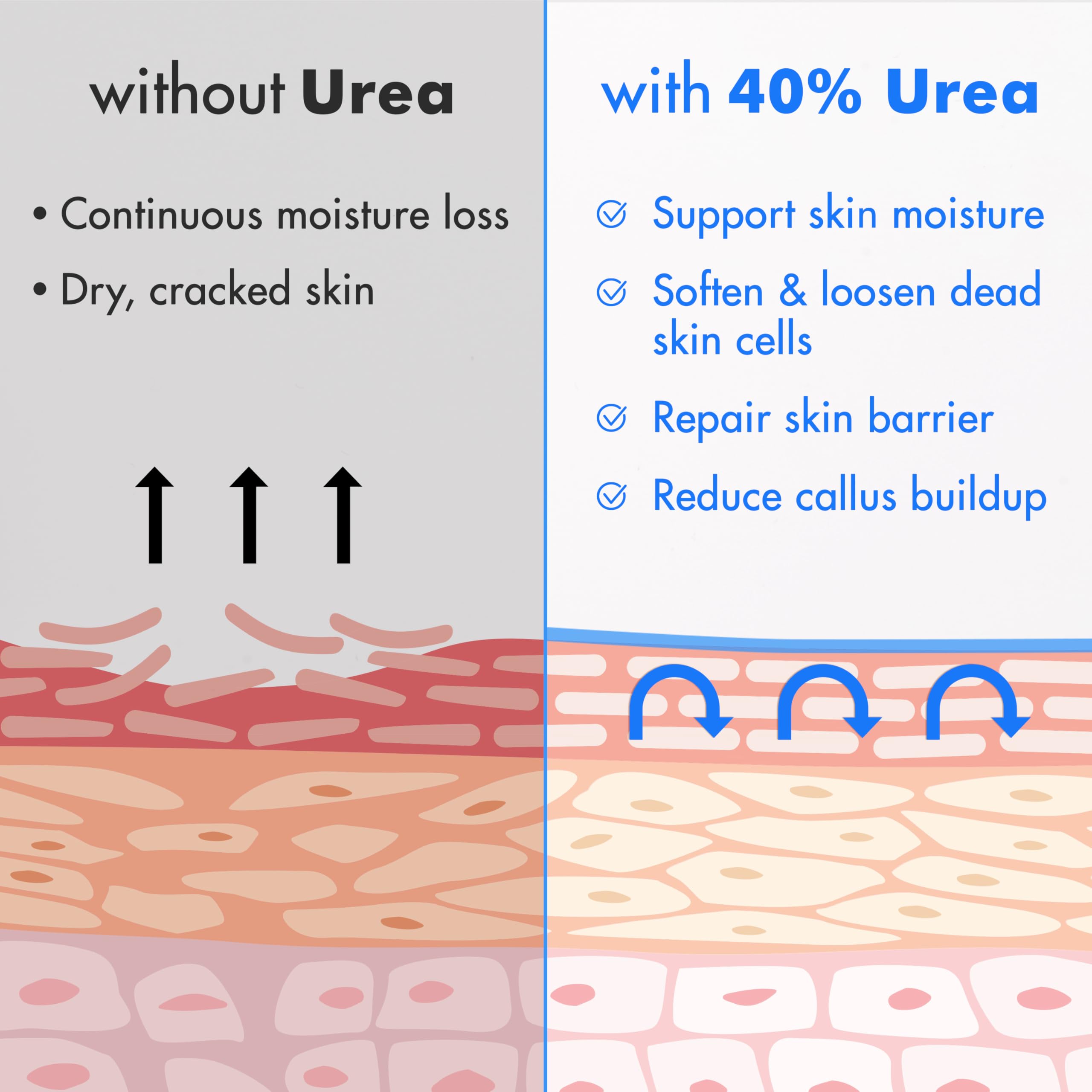 Ebanel Urea Cream 40% plus Salicylic Acid 2%, Foot Cream for Dry Cracked Heels Feet Knees Elbows Hands, Foot Dead Skin Cuticle Callus Remover Toenail Softener, Keratolytic Skin Barrier Repair Ebanel buy australia supplements
