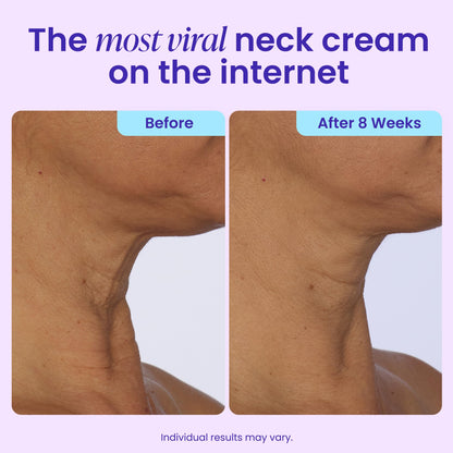 goPure Tighten & Lift Neck & Chest Moisturizer Cream for Visibly Firming, Tightening and Lifting the Look of Wrinkles & Crepey Skin, 1.7oz goPure