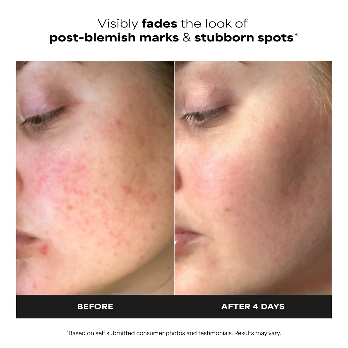 Paula's Choice BOOST 10% Azelaic Acid Booster Cream Gel, 1 Fl Oz Paula's Choice