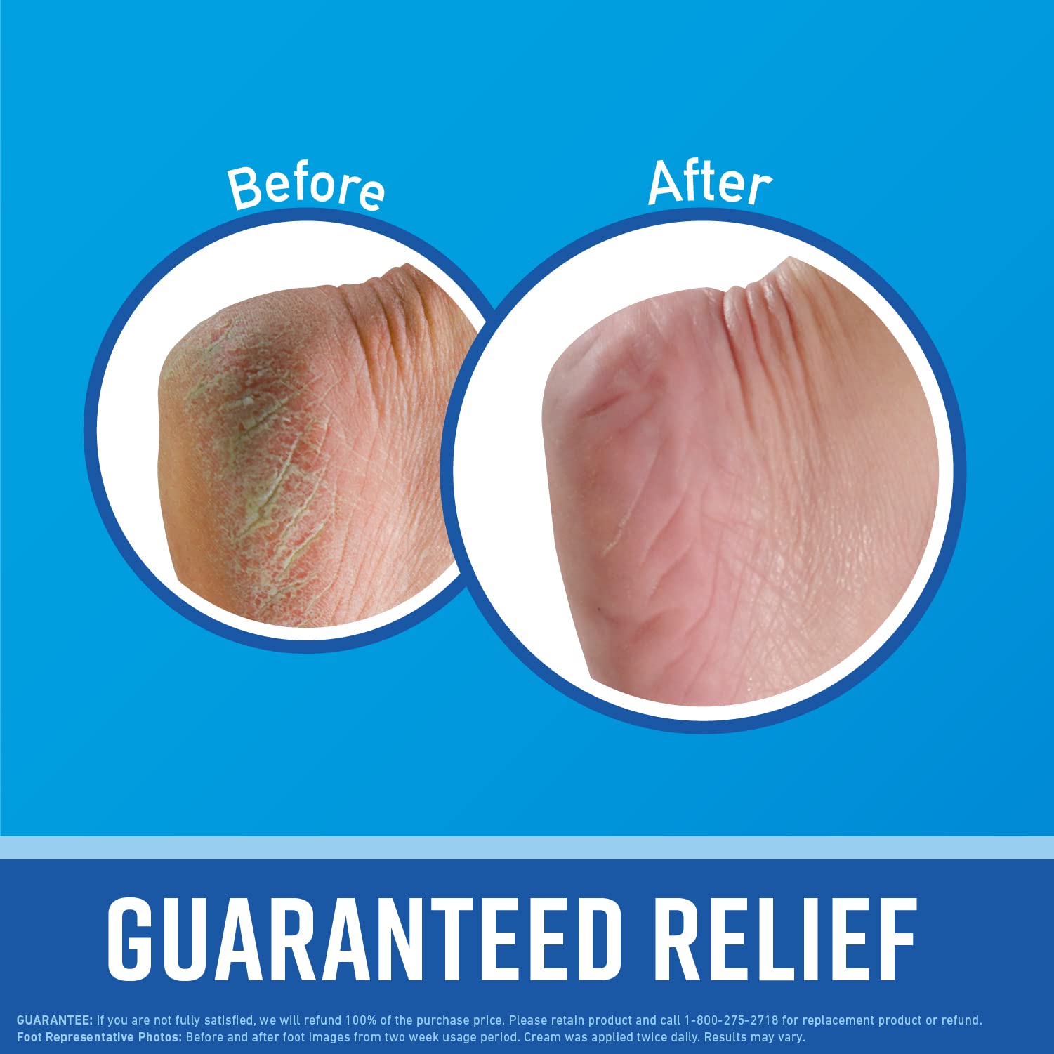 O'Keeffe's for Healthy Feet Foot Cream, Guaranteed Relief for Extremely Dry, Cracked Feet O'Keeffe's buy australia supplements