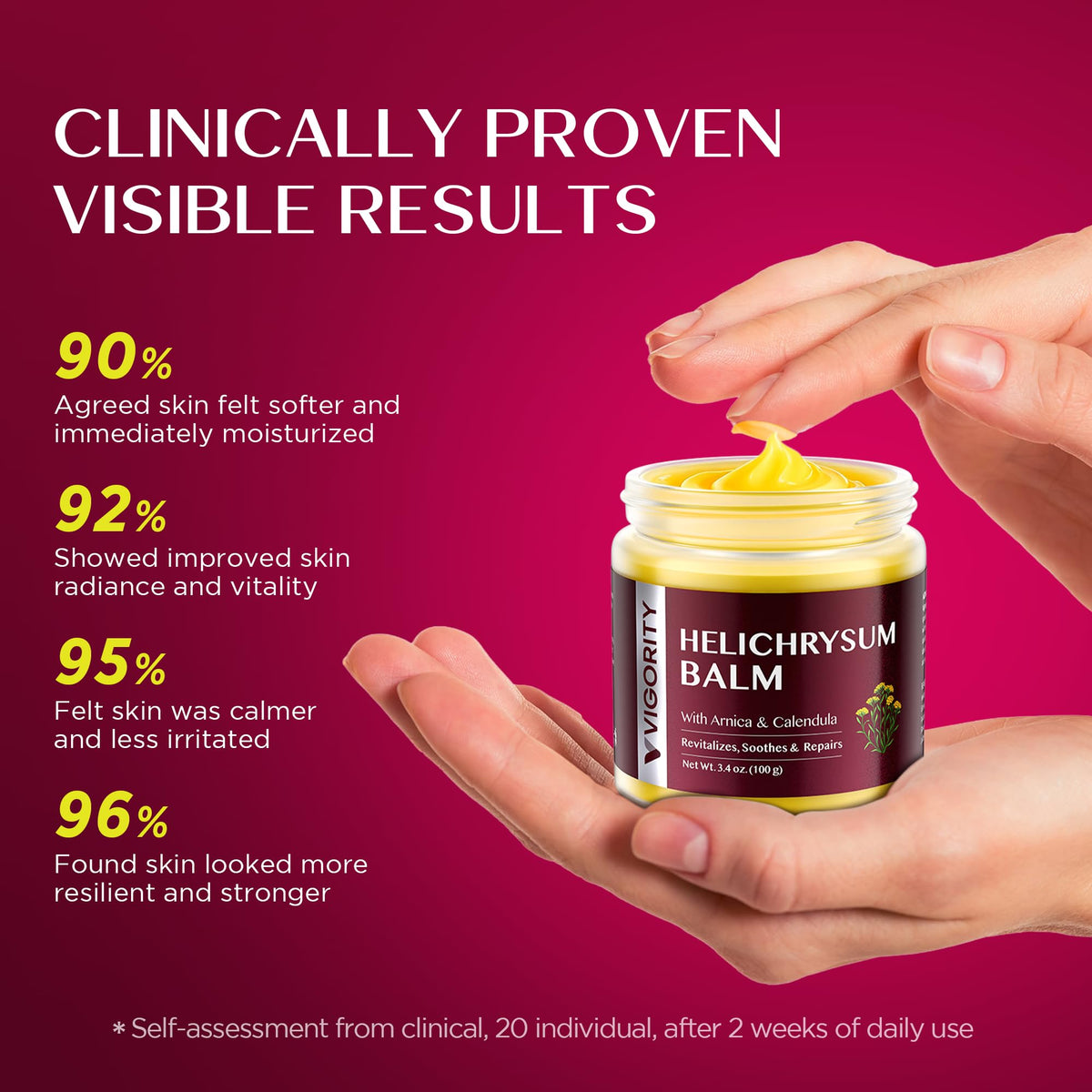 Vigority Helichrysum Balm Soothes & Repairs: Restorative Arnica Cream with Calendula for Fragile, Thin Skin & Bruise-Prone – Moisturizes, Revitalizes & Strengthens Skin Barrier for Adult Seniors 3.4oz Vigority