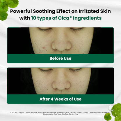 Dr. G R.E.D. Blemish Clear Soothing Cream - Calming Korean Moisturizer for Redness - Soothes Acne & Irritation Dr.G