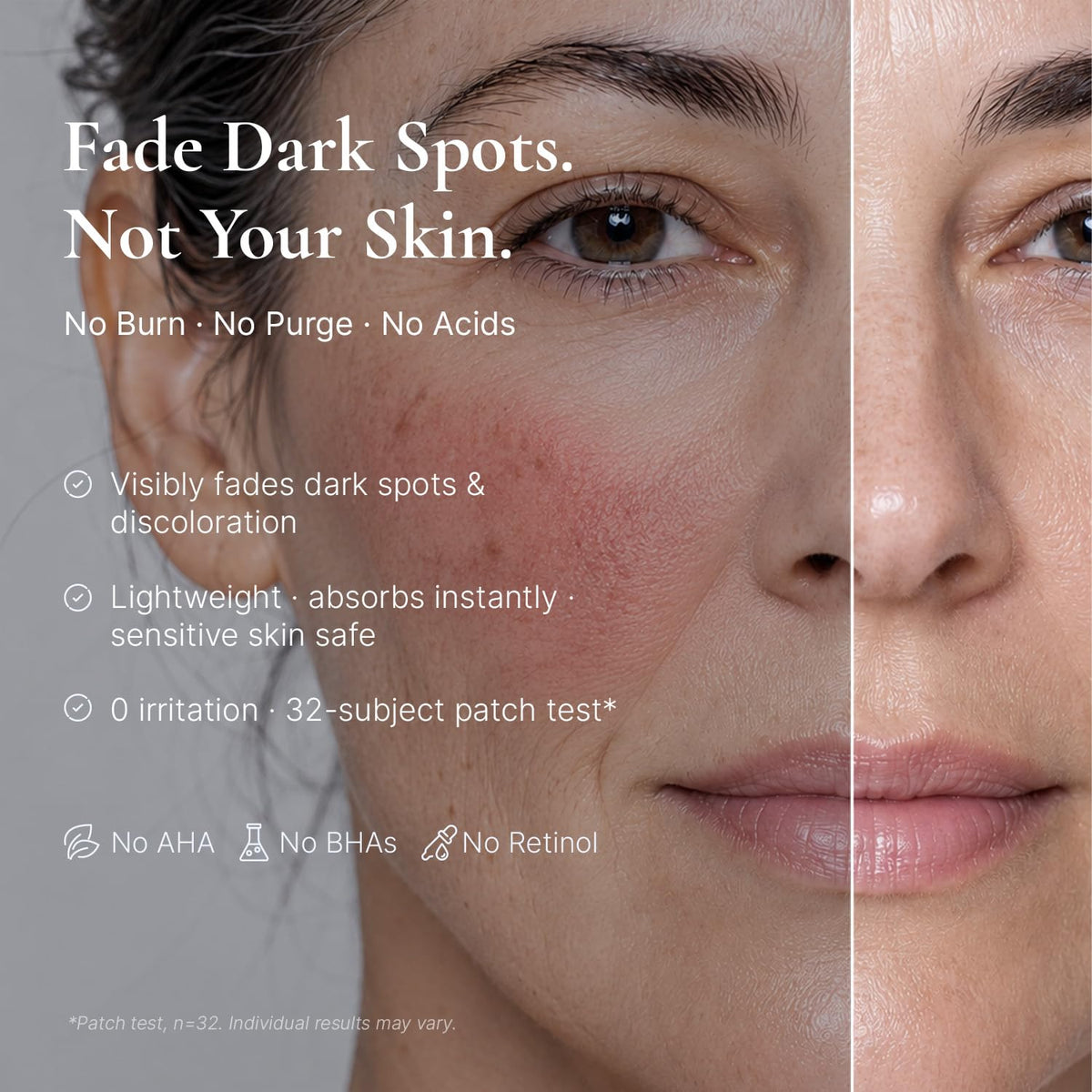 EnaSkin Dark Spot Corrector & Remover Serum for Face & Body, Niacinamide EnaSkin