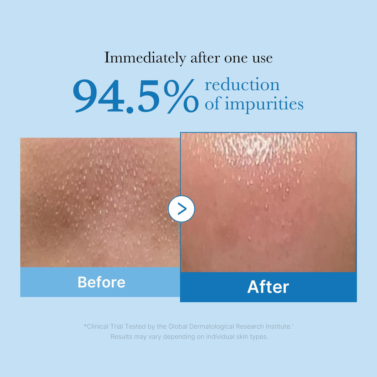 medicube Cleansing Oil Zero Pore Blackhead medicube