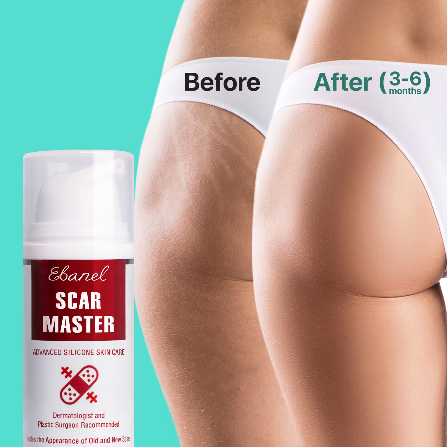 Ebanel Bundle of Advanced Silicone Scar Gel 1 Oz, and Hyaluronic Acid Serum Ebanel buy australia supplements