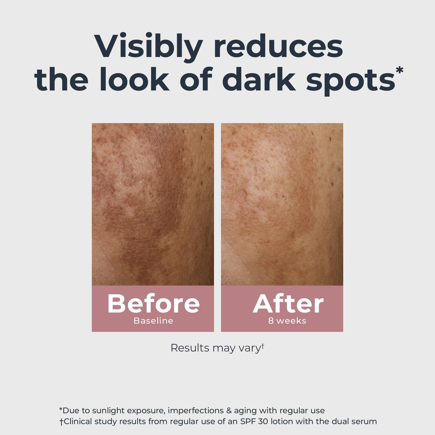 Eucerin Radiant Tone Dual Serum Dark Spot Corrector, Dark Spot Serum with Thiamidol Eucerin