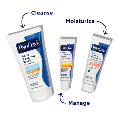 PanOxyl Acne Clearing Spot Treatment, 10% Benzoyl Peroxide, For Face, 1 oz PanOxyl