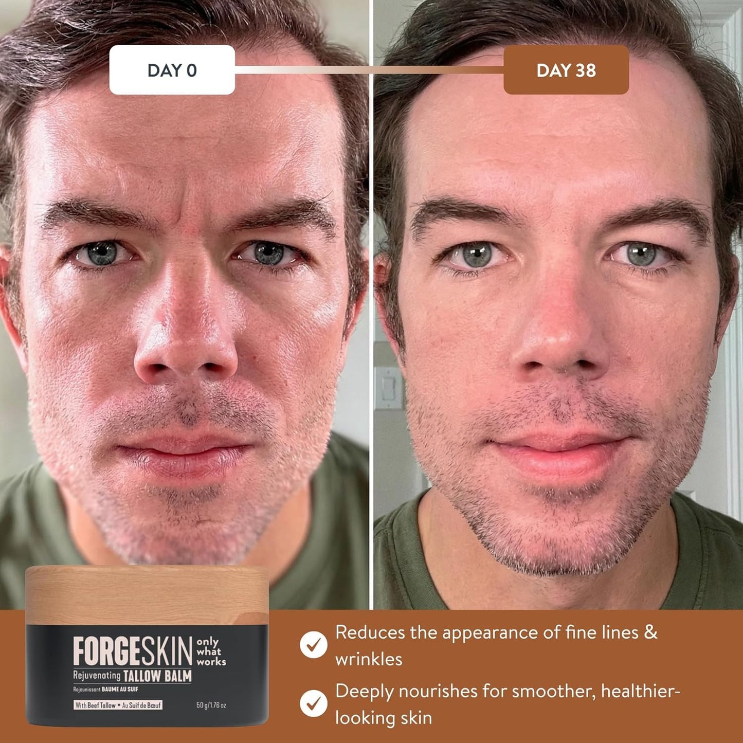 Forge Skin® Wrinkle Defense Beef Tallow Balm for Men [TALLOW-BASED] Moisturizer for Face Hydration - Hydrating Anti Aging Skin Cream Forge Skin