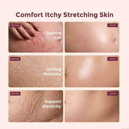 Momcozy Pro-Collagen Belly Firming Moisturizer Stretch Mark Cream 0.54 oz Momcozy