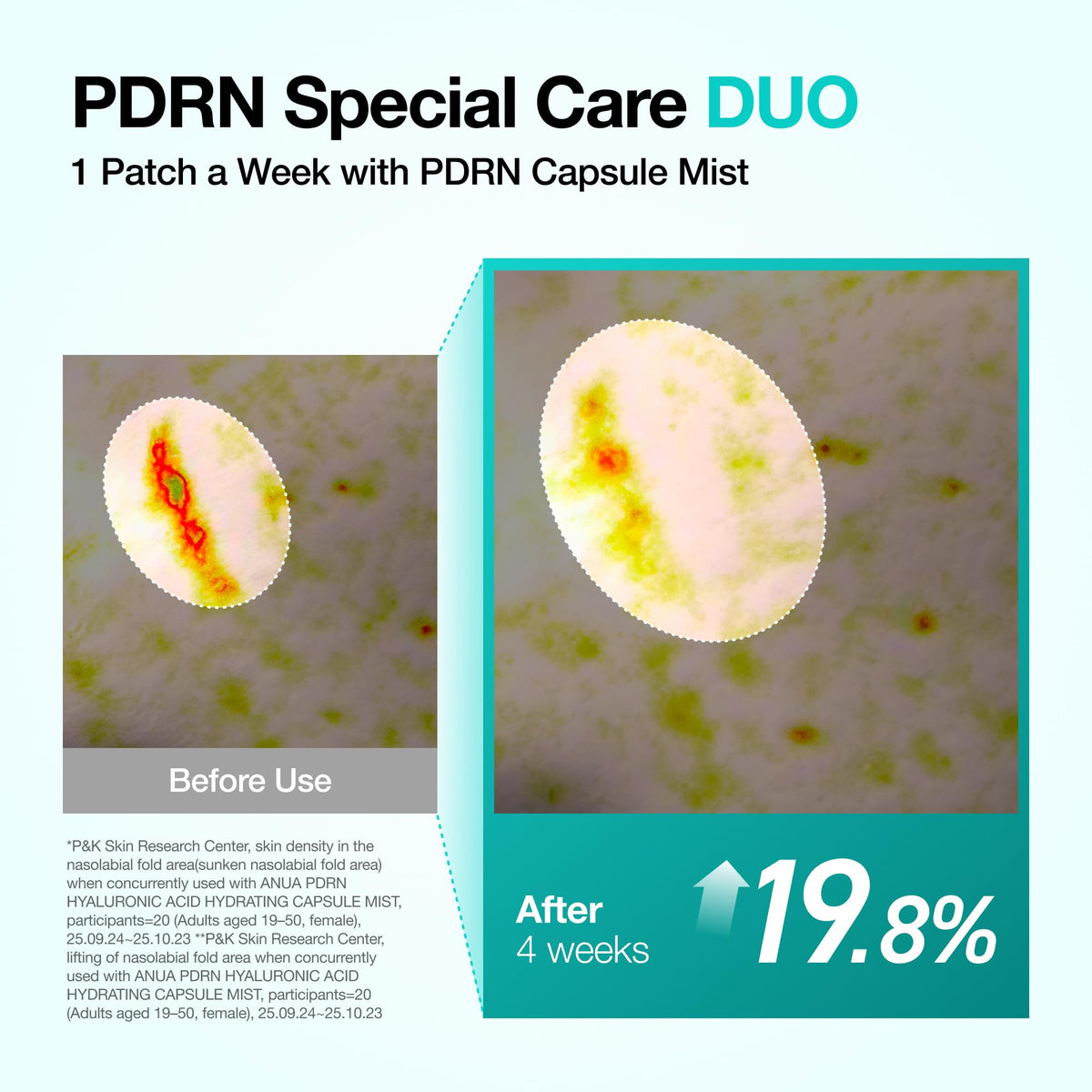 ANUA Salmon DNA PDRN Collagen Melting Patch for Glass skin, 2 Pairs x 4ea ANUA