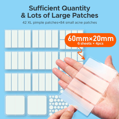 TKTK Large Pimple Patches for Face & Body Zit Breakouts, 7 Sizes 126 Count TKTK