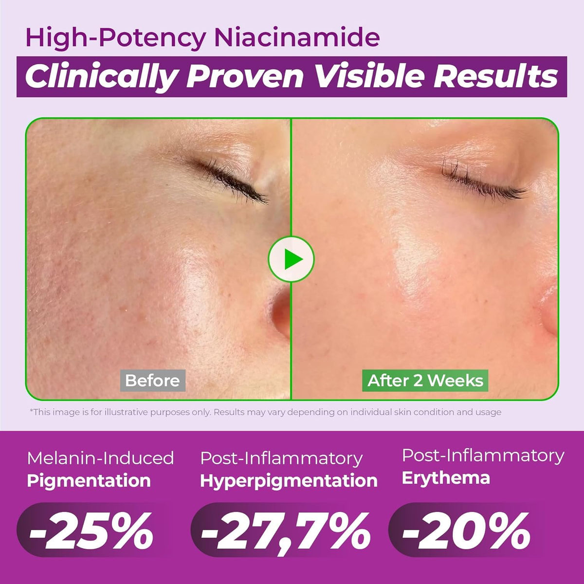 JUMISO 20% Niacinamide Dark Spot Correcting Serum for Face, 1.35 fl oz JUMISO