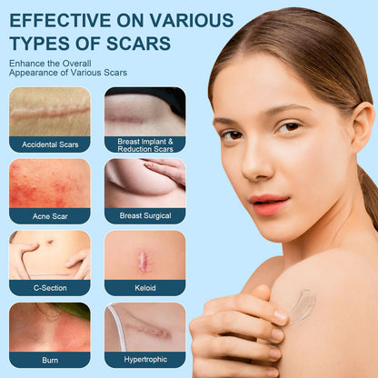 Mitgary Advanced Scar Gel, Silicone Scar Gel, Treats Old and New Scars, Reduces the Appearance of Scars from, Body, Face, Stretch Marks, Surgical Scar, Keloids, Acne, Burns and More, 50g (1.7 Oz) Mitgary