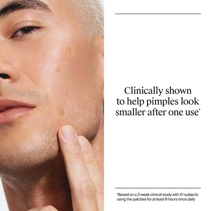 Neutrogena Stubborn Acne Patches, Ultra-Thin Pimple Patches, 24 Ct Neutrogena