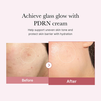 medicube PDRN Pink Hyaluronic Moisturizing Cream | Blemish Recovery, Relief & Hydrating Care | Restores Skin Elasticity & Glow medicube