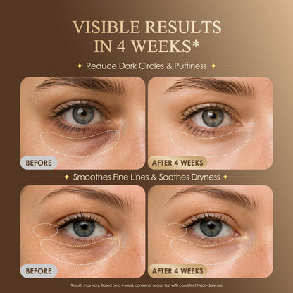 Under Eye Serum for Dark Circles & Puffiness : Caffeine Retinol Peptide Eye Serum for Fine Lines and Wrinkles, Hydrating Daily Eye Care for Women & Men, 0.7 fl oz BIYSBER