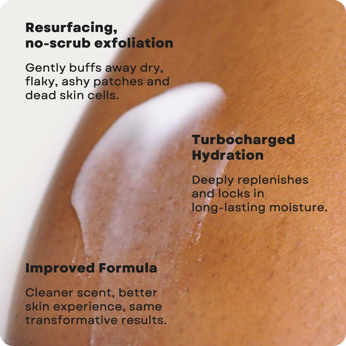 AmLactin Intensive Healing Body Lotion, 15% Lactic Acid, 14.1 oz Amlactin