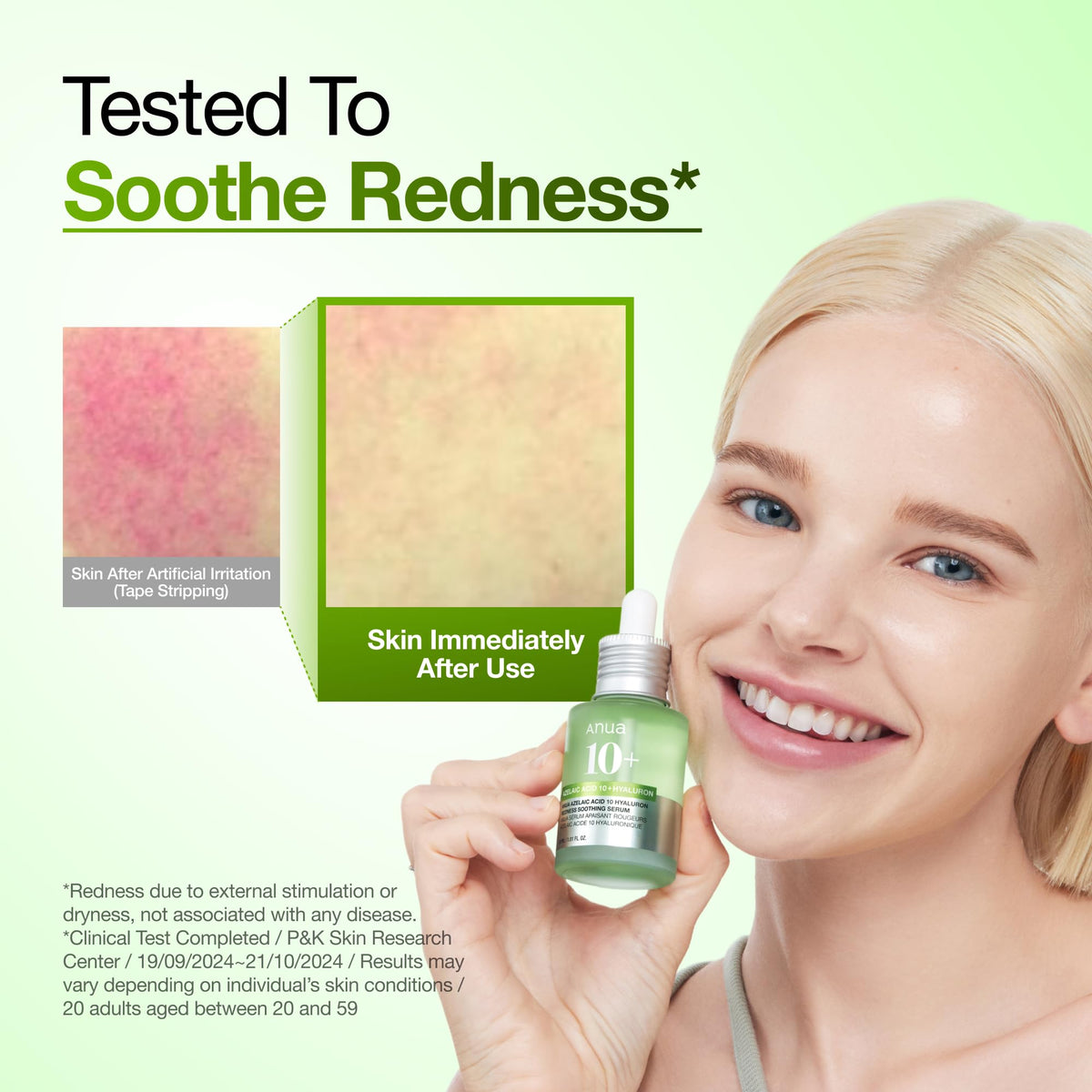 Anua Azelaic Acid 10 Hyaluron Redness Soothing Serum, 1.01 fl oz ANUA