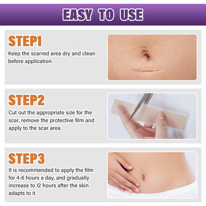 Silicone Scar Sheets,Silicone Scar Tape,Silicone Scar Removal Strips for Surgical,C-Section,Tummy Tuck,Keloid Scars Psecici