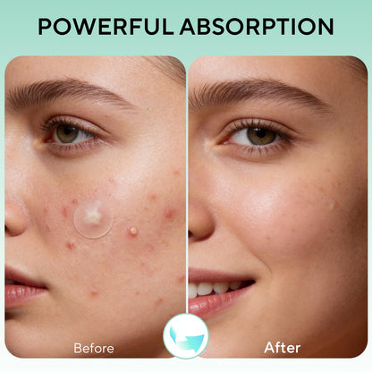 QUSTERE 580 Count Pimple Patches for Face, Large Hydrocolloid Acne Patches Stickers Bandages, Blemishes Zit Breakouts for Cheeks, Forehead, Chin, Nose for Full Face & Body | 7 Sizes | 4 Shapes QUSTERE