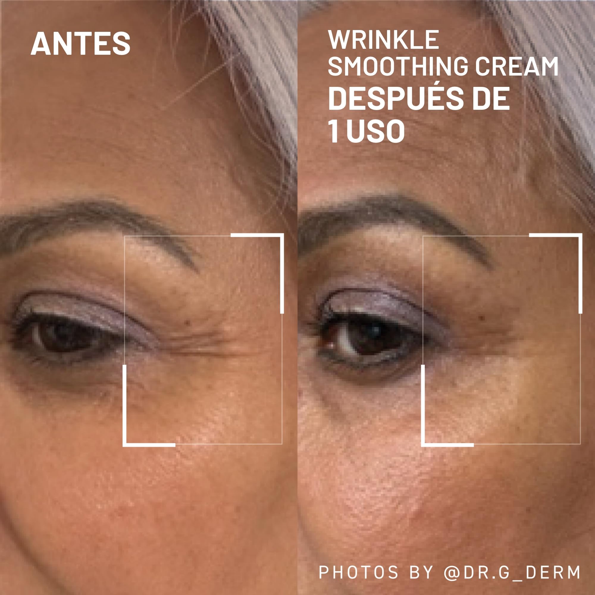 Dr. Brandt Needles No More Wrinkle Smoothing Cream - Smooths Expression Lines, Firms & Protects the Skin - 0.5 oz Dr. Brandt Skincare buy australia supplements
