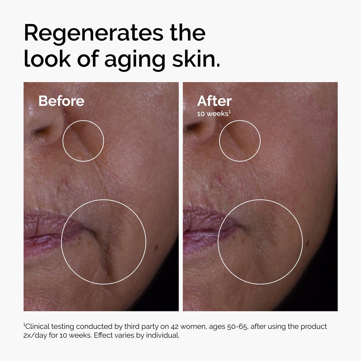 The Ordinary GF 15% Solution, Anti-Aging Formula for Visible Skin & Wrinkle Repair, 1 Fl Oz The Ordinary