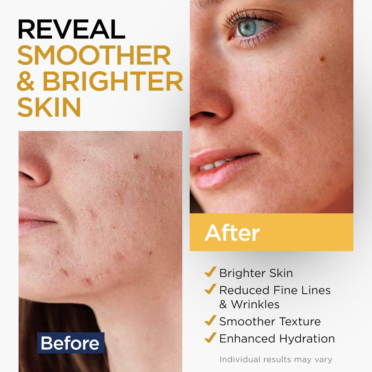 Ember Cloud Vitamin C Serum for Face with Stem Cells & Hyaluronic Acid 1 Oz Ember Cloud