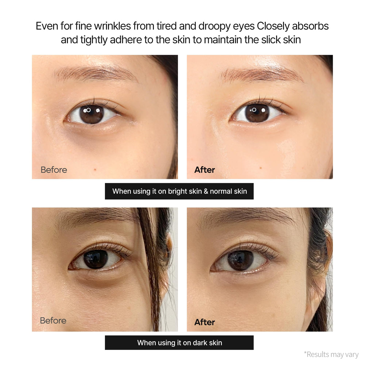 Dr.Melaxin Calcium Dark Spot Eye Cream 15g – Niacinamide & Calcium Gluconate Eye Cream for Dark Circles, Under Eye Bags & Sagging | Hydrolyzed Elastin EX Volume Firming | Korean Eye Cream Dr.Melaxin